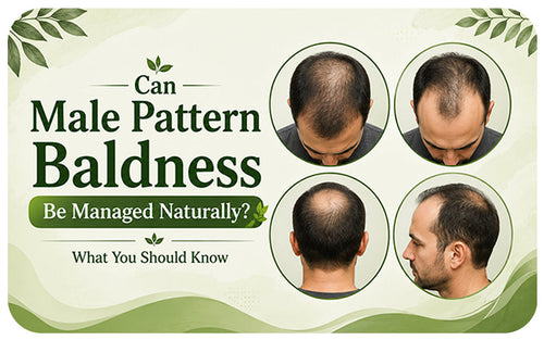 Can Male Pattern Baldness Be Managed Naturally? What You Should Know